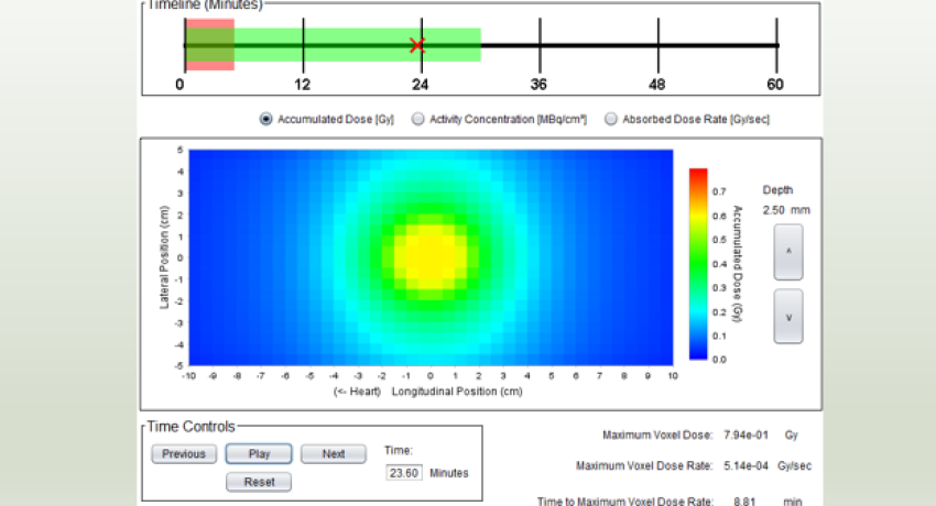 A visual overview of the results window of the V+ extravasation dosimetry module